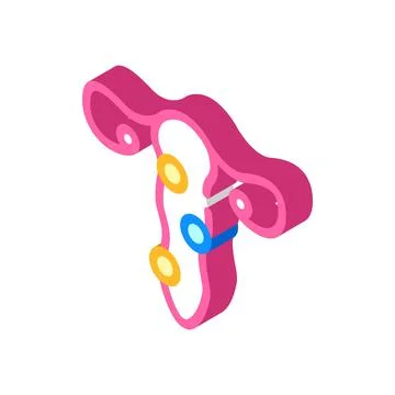 Pathology of cervix isometric icon vector illustration 스톡 일러스트