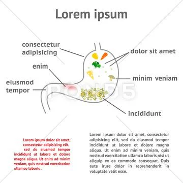 Pathology of the stomach and digestive Stock Illustration