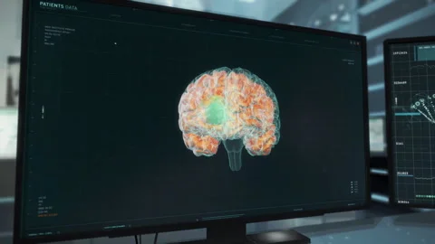 Patient Brain Analysis Results Showcasing In A Futuristic Hospital Laboratory Stock Footage 256600814