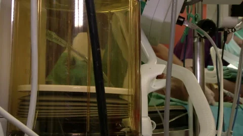 Patient breathes using ventilator during surgery in operation room. Hospital. Stock Footage 61070061
