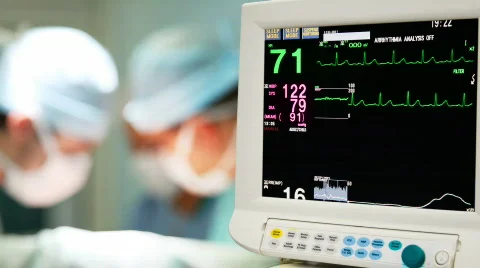 Patient cardiogram monitoring in operation room Stock Footage
