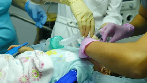 Patient child under anesthesia, little g... | Stock Video | Pond5