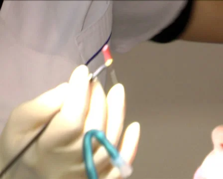 Patient at the dentist 14 Stock Footage 35015504