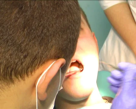 Patient at the dentist 16 Stock-Footage 35015463