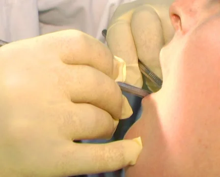 Patient at the dentist 9 Stock-Footage 35015411