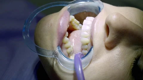 Patient at the dentists appointment Stock Footage 149262460