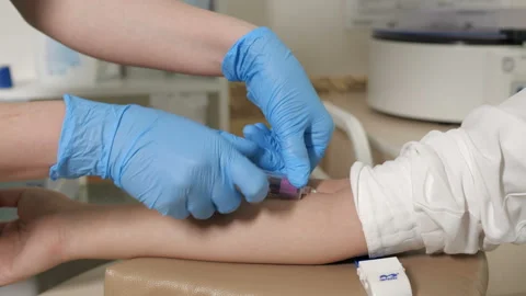 Patient is doing a blood test Stock Footage 91625624