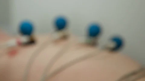 Patient with EKG  Stock-Footage 129731598