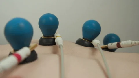 Patient with EKG  Stock Footage 129731636