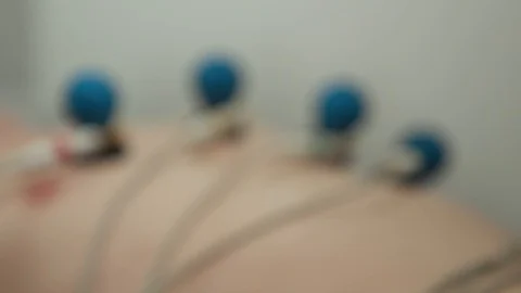 Patient with EKG  Stock-Footage 129731641