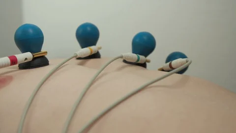 Patient with EKG  Stock Footage 129731656