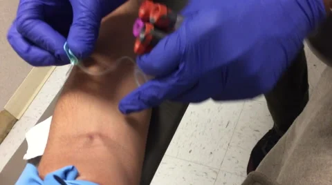 Patient Giving Blood, Close UP Procedure Stock Footage 58585953