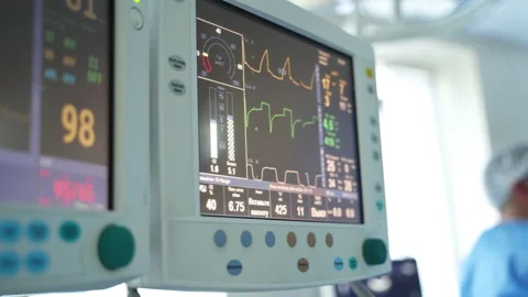 Patient heartbeat at the screen Stock Footage 155410139