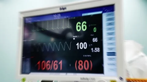 Patient heartbeat at the screen Stock Footage 173728359