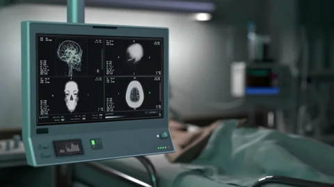 Patient imaging system analyses the brain organ searching for disease symptoms Stockbeeldmateriaal 253189081