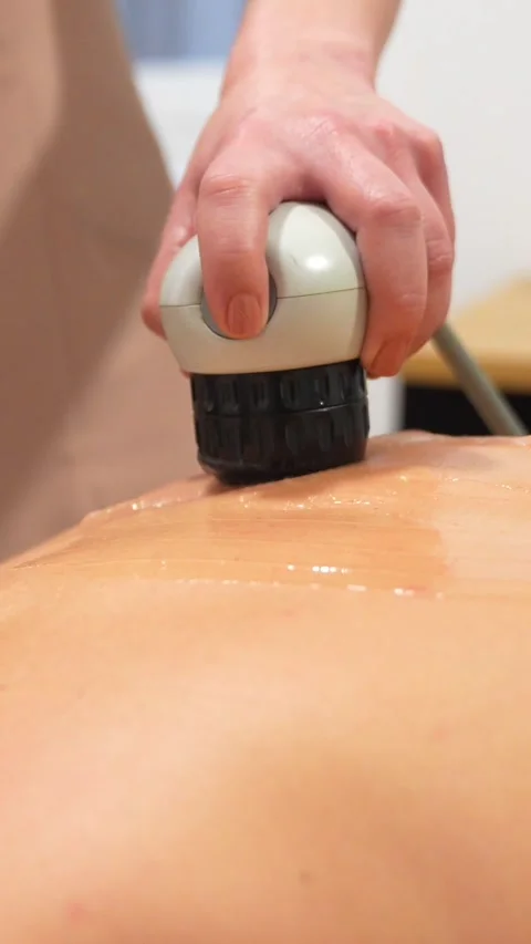Patient lying on stretcher receiving a shockwave alternative therapy massage Stock Footage 273475125
