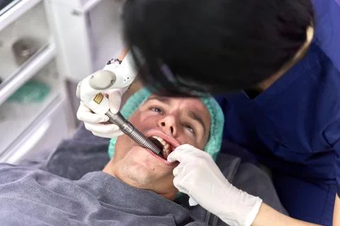 Patient with mouth open while undergoing intraoral facial rejuvenation treatment Stock Photos