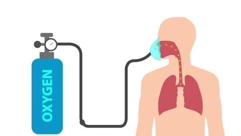 Patient Receiving Oxygen via Nasal Cannula - animation showing a human figu.. Stock Footage 317792353