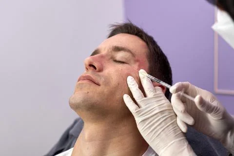 Patient relaxed while getting a rejuvenation treatment with botox injection Stock Photos