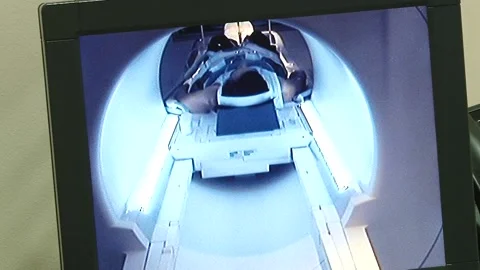 Patient Undergoing Mri Stock Footage 130793885