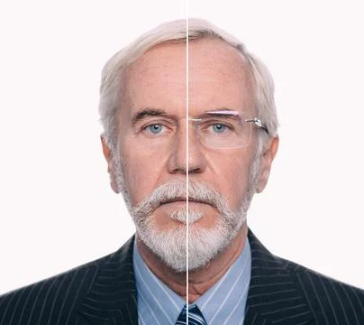Patient undergoing an ophthalmology evaluation with noticeable eye condition, Stock Photos