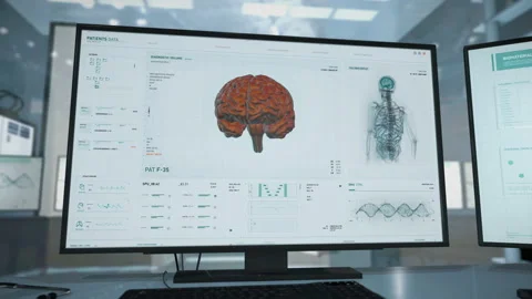 Patient Upper Body Data Scan Via Futuris... | Stock Video | Pond5