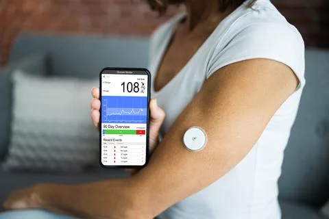 Patient Using Continuous Glucose Sugar Test 写真素材