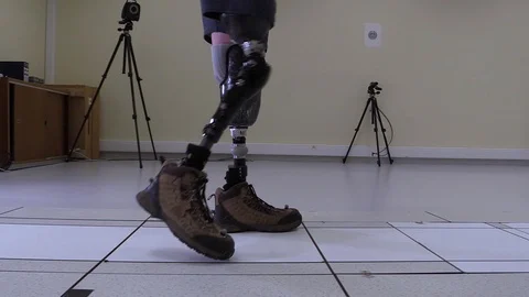 Patient walking with a leg prosthesis Stock Footage 112336569