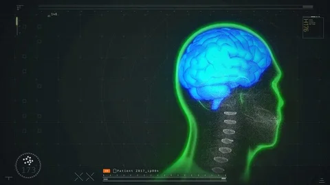 Patient's brain scan test results on screen, disease diagnostics and prevention Stock Footage 71670886