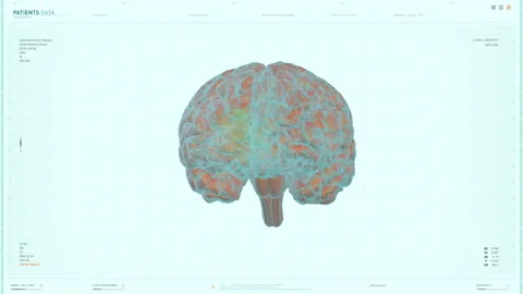 Patients Brain Scanned By High Tech Medical Monitoring System Interface Stock Footage 168671089