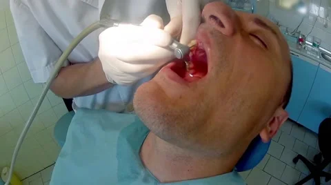 Patient's gum is bleeding because of dentist's intervention, close up Stock Footage 42895252