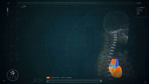Patient's heart in skeleton visualized on screen, futuristic medical software Stock Footage 71672939