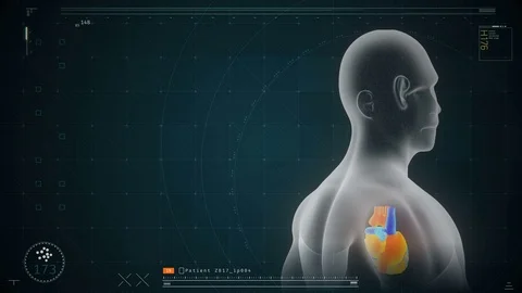 Patient's heart visualization model spinning on screen, monitoring software Stock Footage 71672646