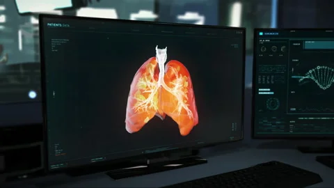 The Patient`s Lungs are being Analyzed for Covid Traces in the modern Laboratory Stock Footage 153097328