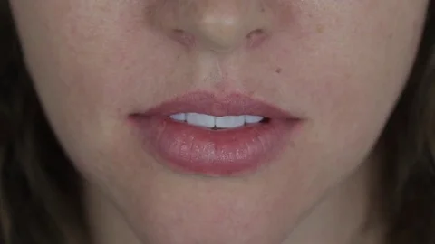 The patient's smile Stock Footage 76808275