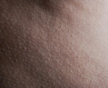 Pattern of human skin with bumps Stock Photos