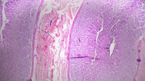 Pattern of human stomach in section studied in lab under microscope 40x on Stock Footage 247794946