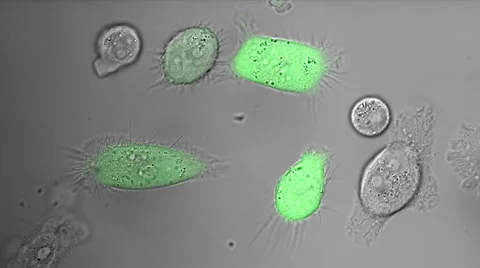 PC-3 human prostate cancer cells in culture. Stock Footage 61682774