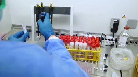 PCR test taking a sample from the tube coronavirus tube Stock Footage 150565136