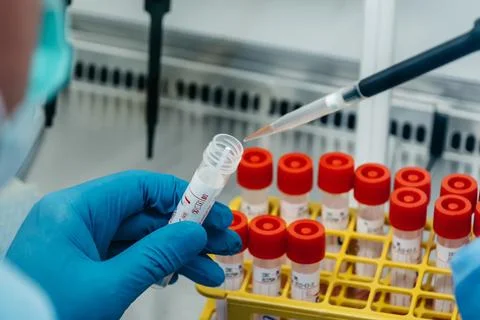 The PCR tester takes a sample analysis from a test tube Stock Photos