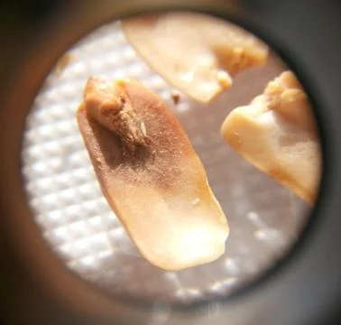 Peanuts under the microscope under the increase of spoiled mycotoxins fungi mold Stock Photos