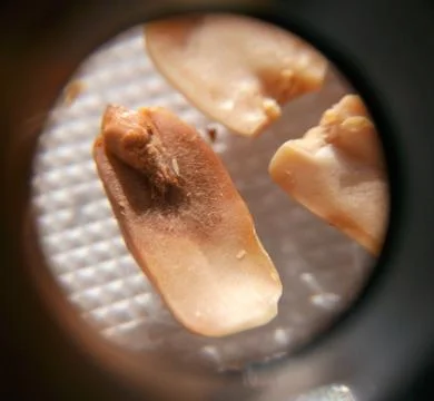 Peanuts under the microscope under the increase of spoiled mycotoxins fungi mold Stock Photos