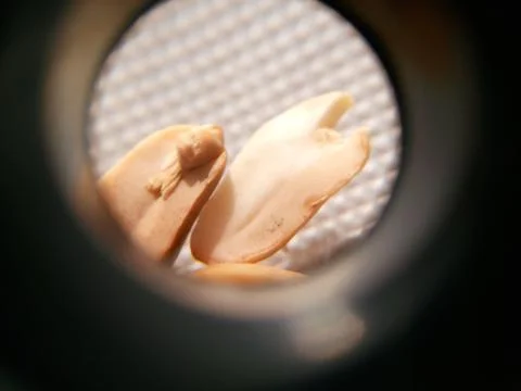 Peanuts under the microscope under the increase of spoiled mycotoxins fungi mold Foto stock