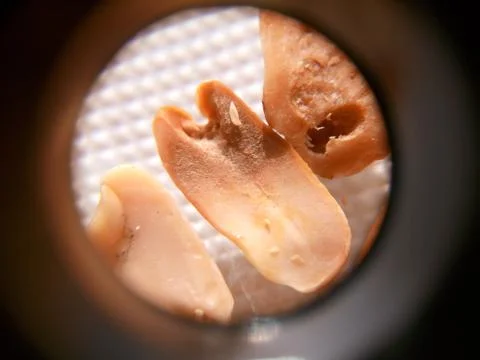 Peanuts under the microscope under the increase of spoiled mycotoxins fungi mold Stock Photos