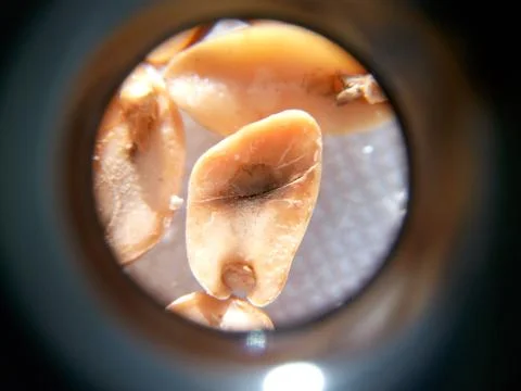 Peanuts under the microscope under the increase of spoiled mycotoxins fungi mold Stock Photos