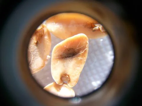 Peanuts under the microscope under the increase of spoiled mycotoxins fungi mold Stock Photos