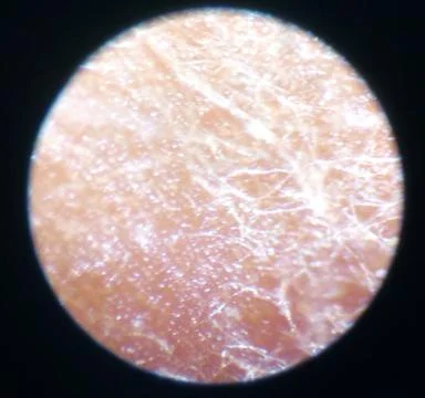 Peanuts under the microscope under the increase of spoiled mycotoxins fungi mold Stock Photos