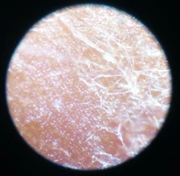 Peanuts under the microscope under the increase of spoiled mycotoxins fungi mold Stock Photos