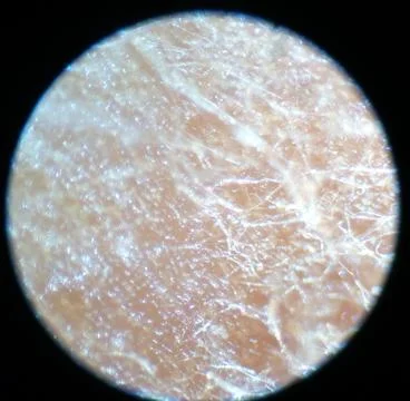 Peanuts under the microscope under the increase of spoiled mycotoxins fungi mold Stock Photos