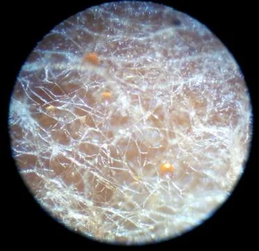 Peanuts under the microscope under the increase of spoiled mycotoxins fungi mold Stock Photos